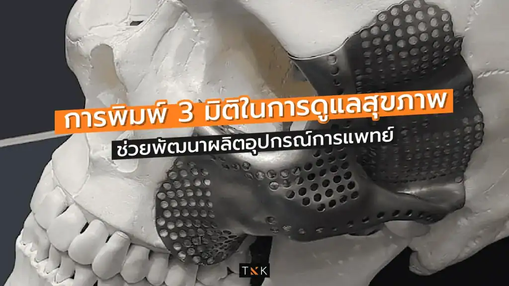 การพิมพ์ 3 มิติ ทางการแพทย์ อวัยวะเทียม